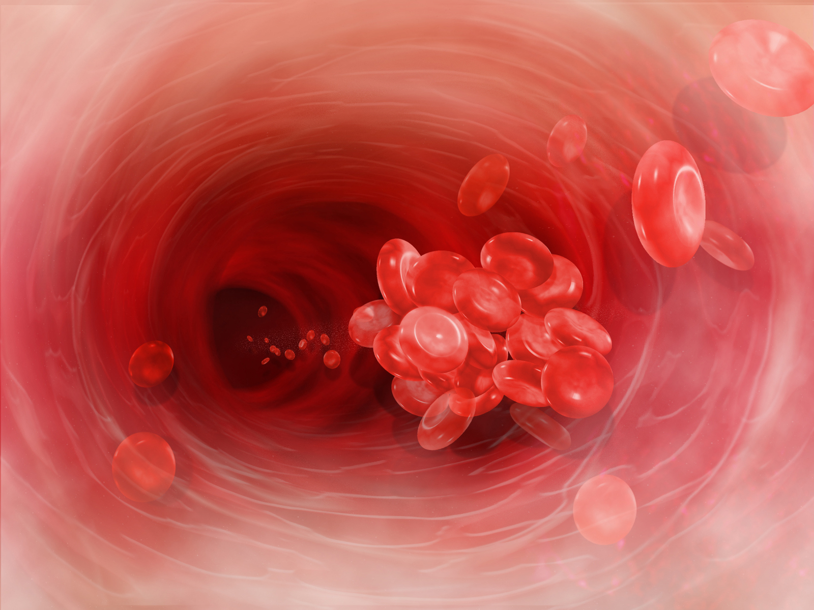 Quick treatment saves a patient’s life; know the signs of thrombosis for life-saving care