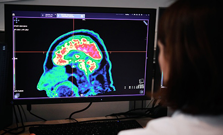 Doctor looking at an MRI brain scan.